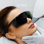 IPL SKIN REJUVENATION